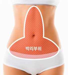 tummy tuck cost korea