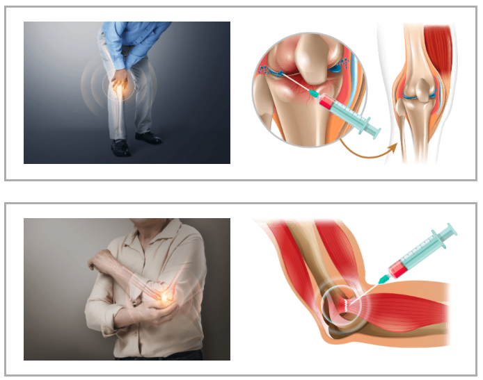 stem cell therapy korea